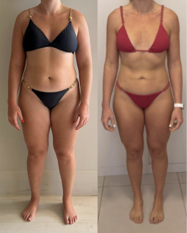 Before-and-after body composition comparison